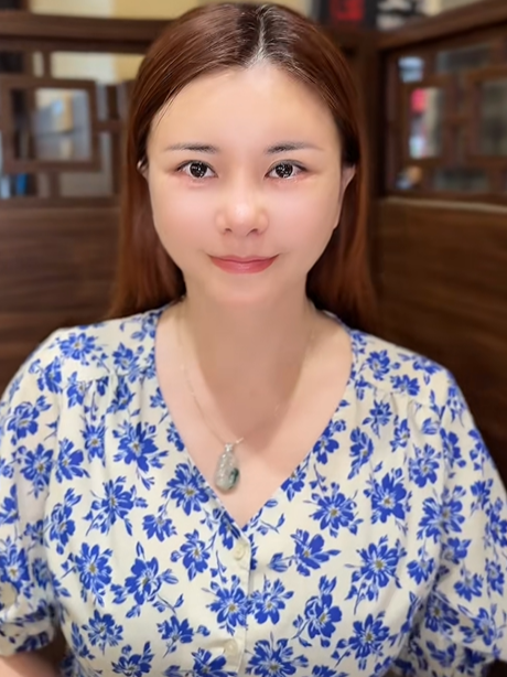 Diện mạo của NSƯT Kim Oanh sau phẫu thuật trẻ hóa ở tuổi 50